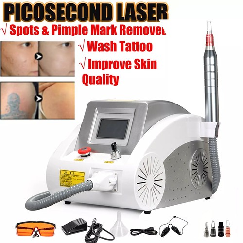 Yag laser - nd,