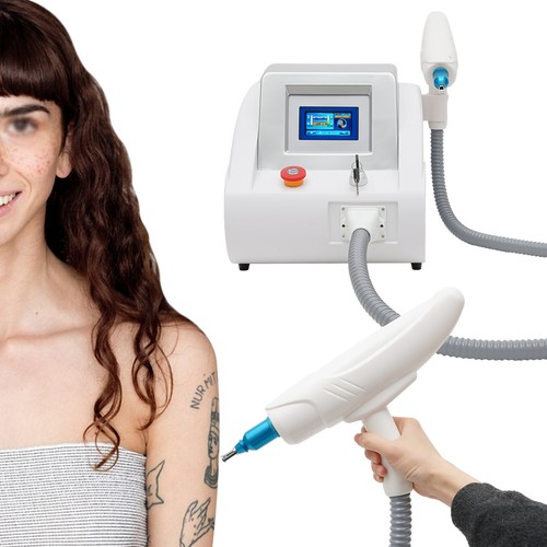 Yag laser tattooentfernung - nd,