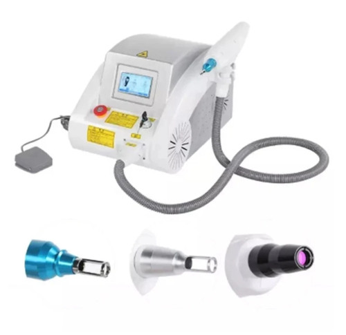Neu yag laser tattoo - nd,