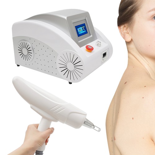 Yag laser tattooentfernung - nd, laser,tattooentfernung