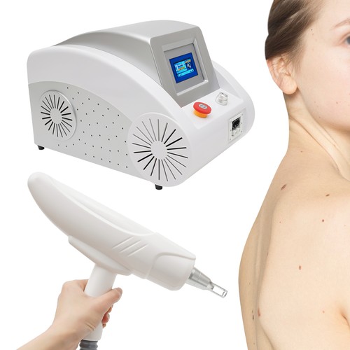 Yag laser tattooentfernung - nd,